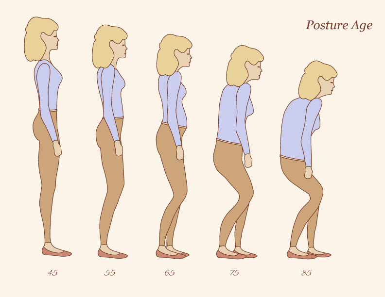 Posture Age Infographic